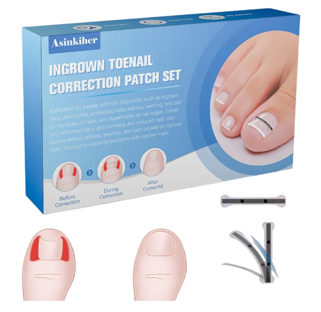 Read more about the article Ingrown Toenail Treatment